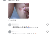 一旦感染终身携带！深圳疾控提醒：这4类人要注意-中石化加油卡网上充值